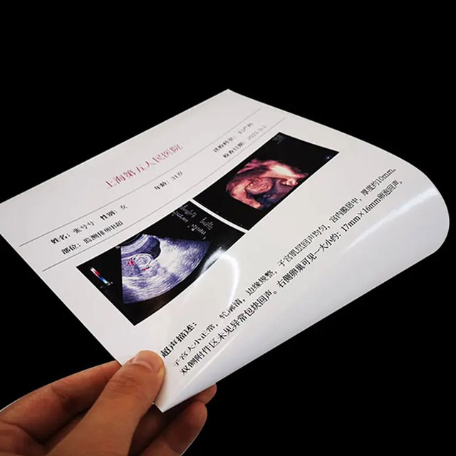 White Inkjet Dry Medical X-ray Film High-Resolution Image Printing Film | DICOM-Compatible Hospital Radiology Supplies