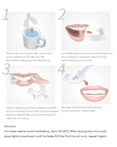 eva thermoforming dental oral hygiene teeth whitening trays bleaching tooth whitener mouth guard care