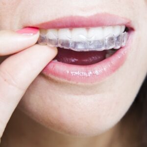 eva thermoforming dental oral hygiene teeth whitening trays bleaching tooth whitener mouth guard care